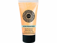 Cos-Medica peeling na aknózní pleť 50 ml